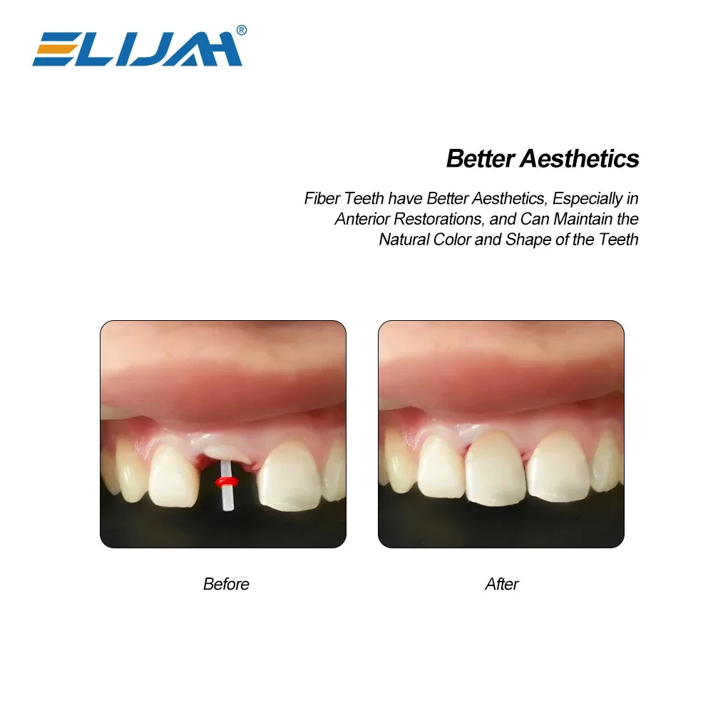 CYW851 20Pcs/Bag Dental Fiber Post - Denspay Dental - Fiber Post