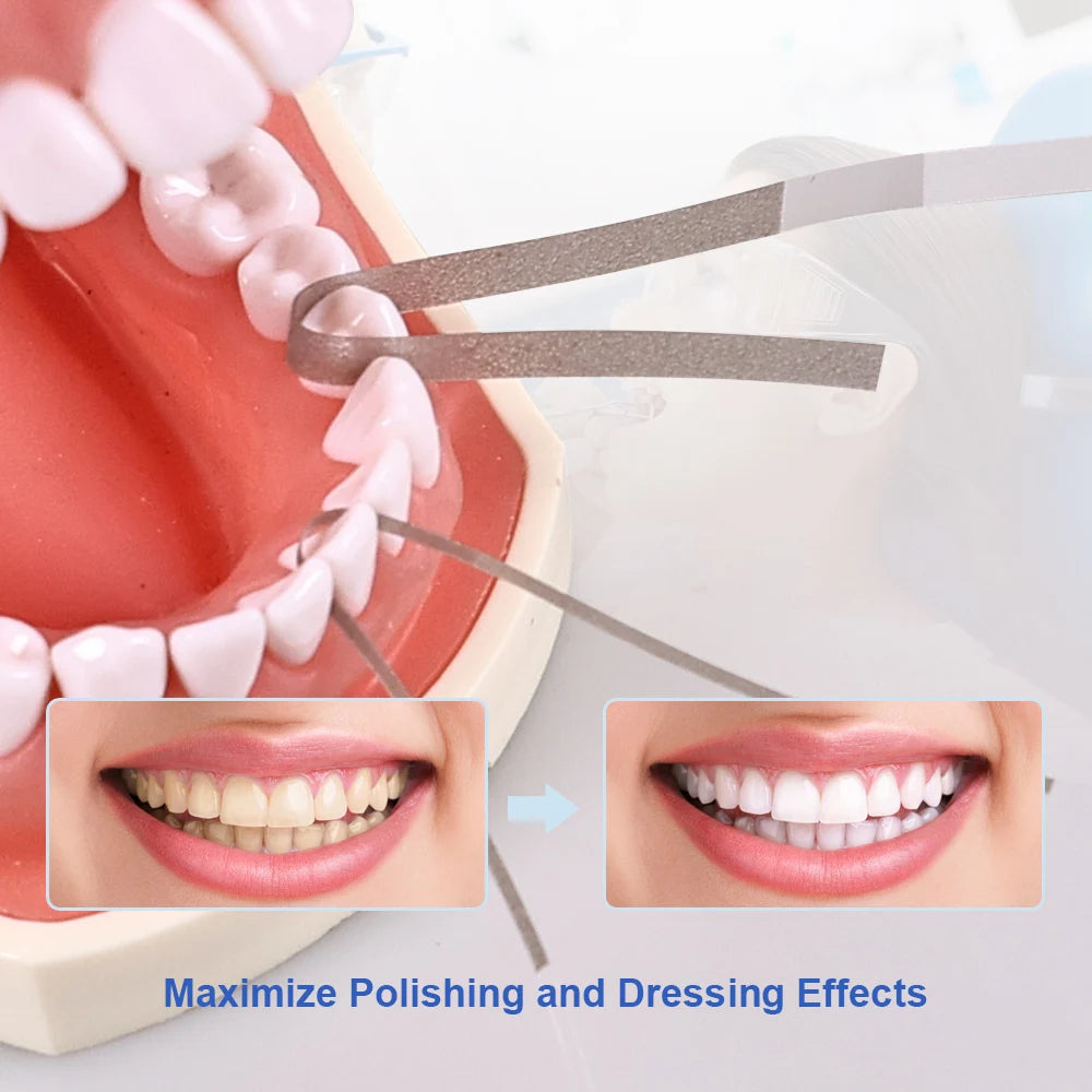 CYW865 Dental Polishing Strips