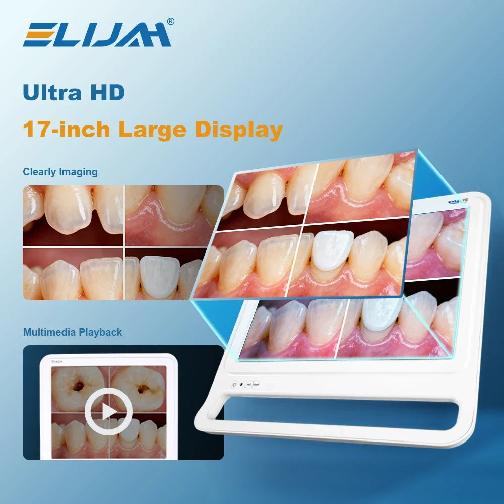 CYN076 Dental Intraoral Camera 17inch Quad Screen