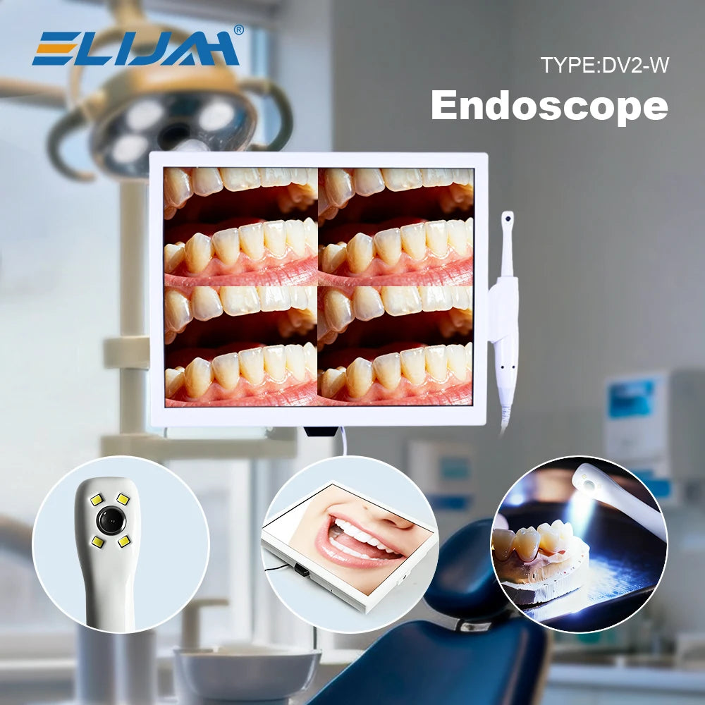 CYN077 Dental Intraoral Camera With Screen - Denspay Dental - Intraoral Camera