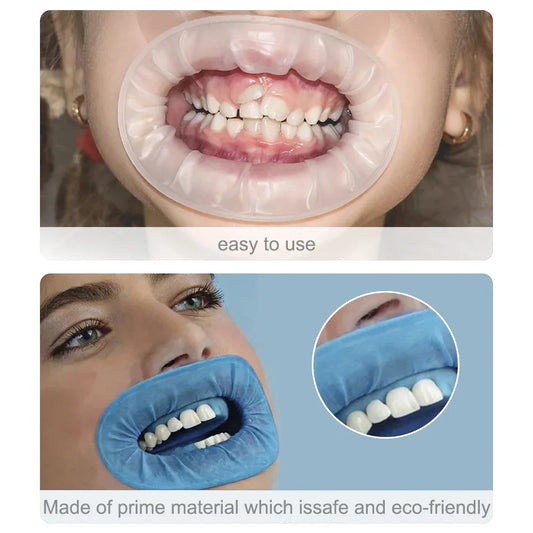 CYW036 Dental O Shape Mouth Opener
