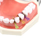 CYW459 Dental Prime Teeth Interproximal Plastic Wedge Guard