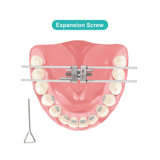 CYZ249 Dental Orthodontic Expansion Screw