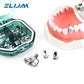 CYZ001 Dental Matrix Bands M4