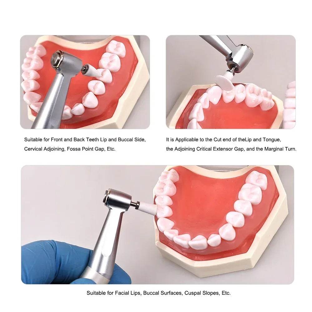 CYF308 Dental Silicone lon Polishing Kit - Denspay Dental - Resin Polishing