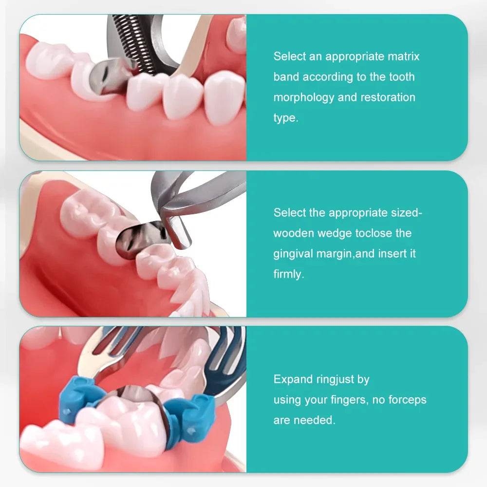 CYW732 Dental Matrix - Denspay Dental - Matrix Bands & Clamp