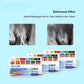 CYF337 Dental Gutta Percha Points - Denspay Dental - Gutta Percha Points