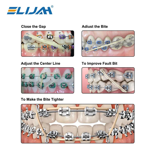 CYZ016 Dental Elastic Rubber Band