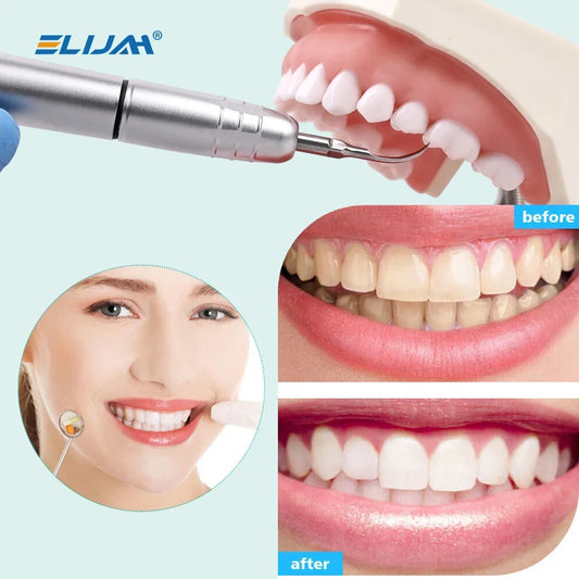 CYB012 Dental Air Scaler