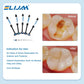 CYU196 DENTEX Dental Composite Resin Kit