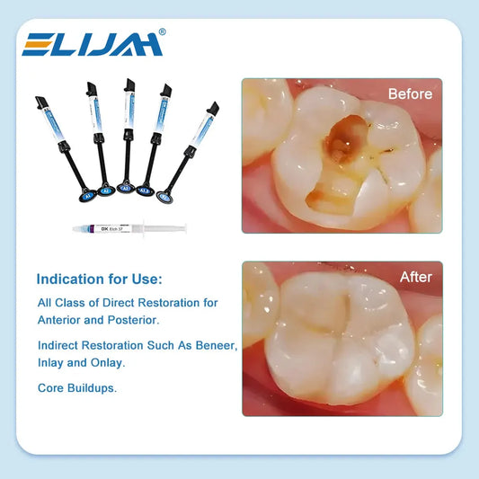 CYU196 DENTEX Dental Composite Resin Kit