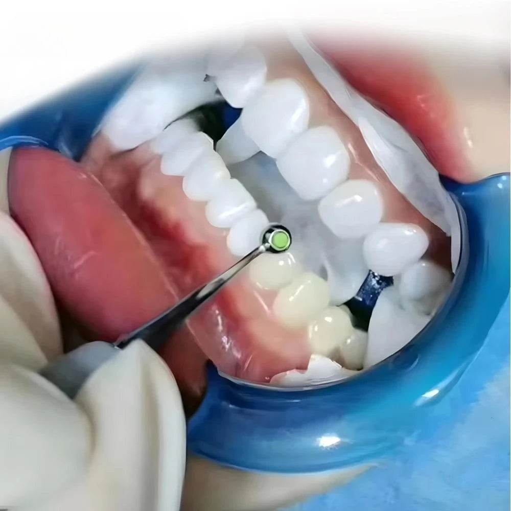 CYW725 Dental Foam Pad Molding Tools - Denspay Dental - Dental Filling Tool