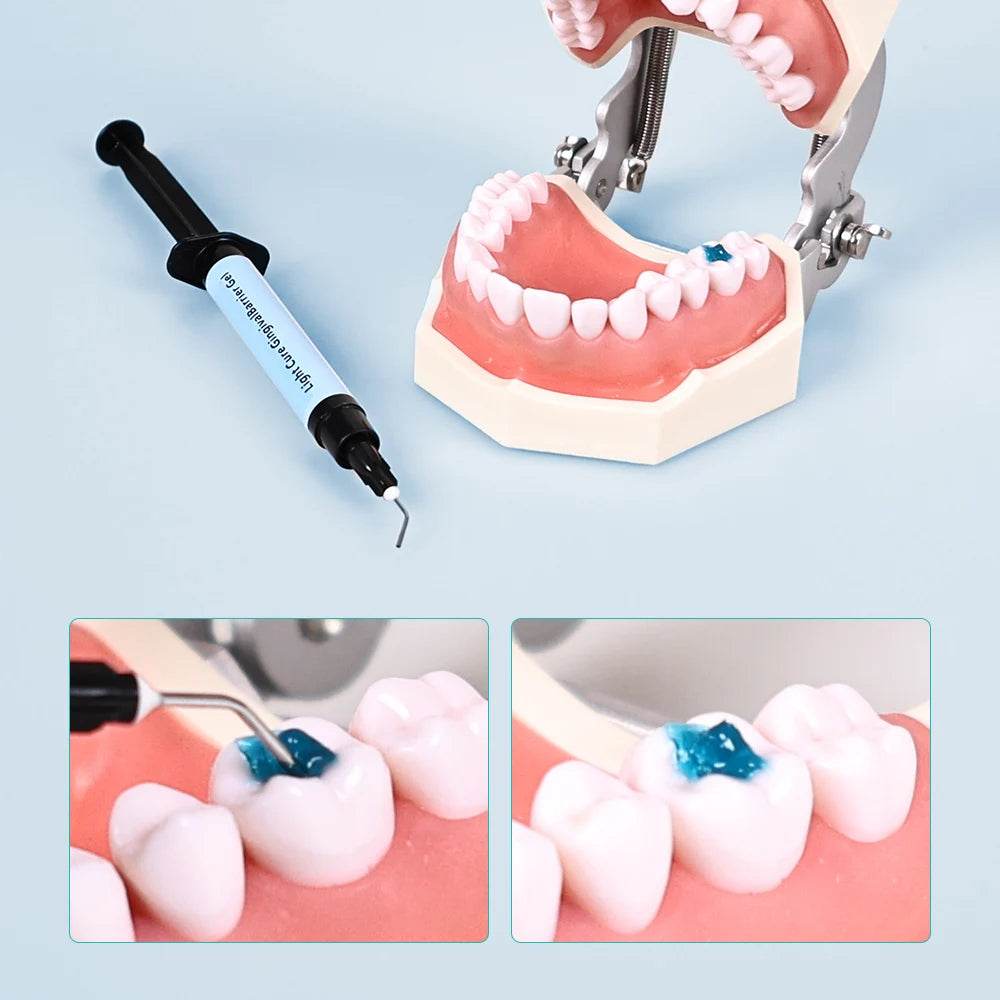 CYU200 Dental Light Curing Guml Barrier Resin - Denspay Dental - Composite Resin