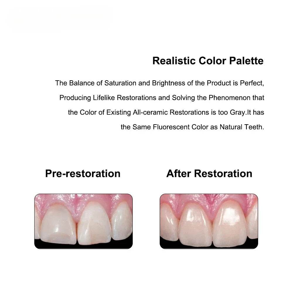 CYU059 Dental Ceramics - Denspay Dental - Dental Ceramics
