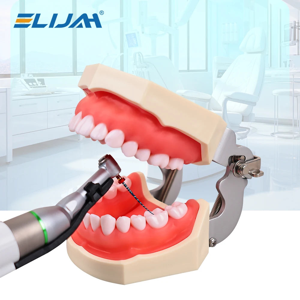 CYF204 NITI Blue Rotary Heat Activated Endodontic Files - Denspay Dental - Self-Adjusting Motor Files