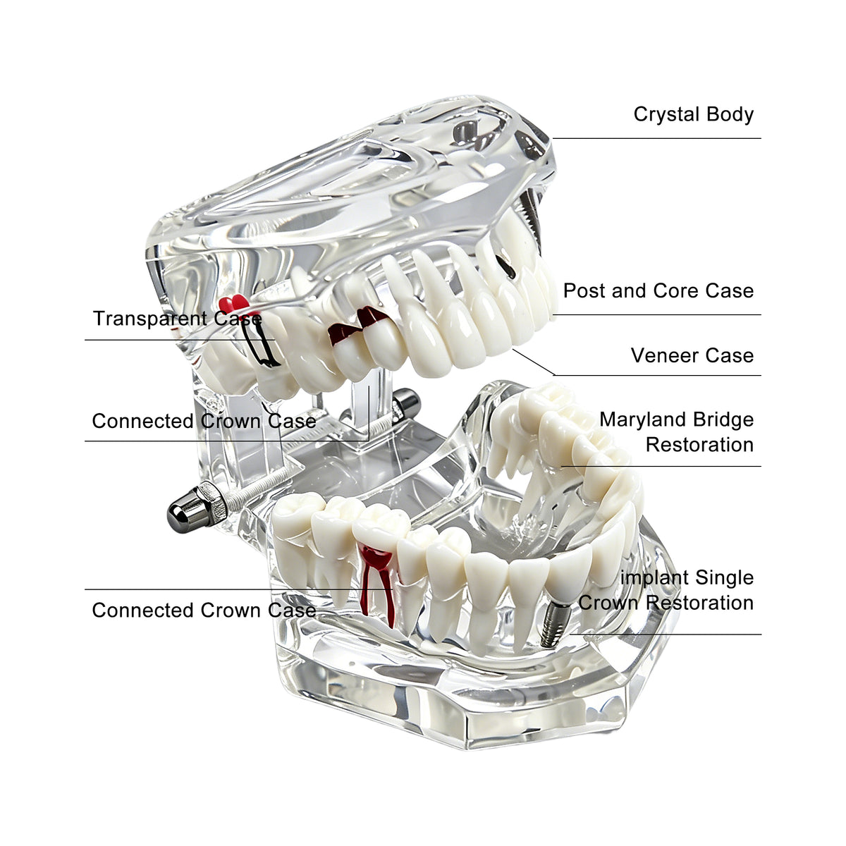Show removable teeth structure of transparent dental model