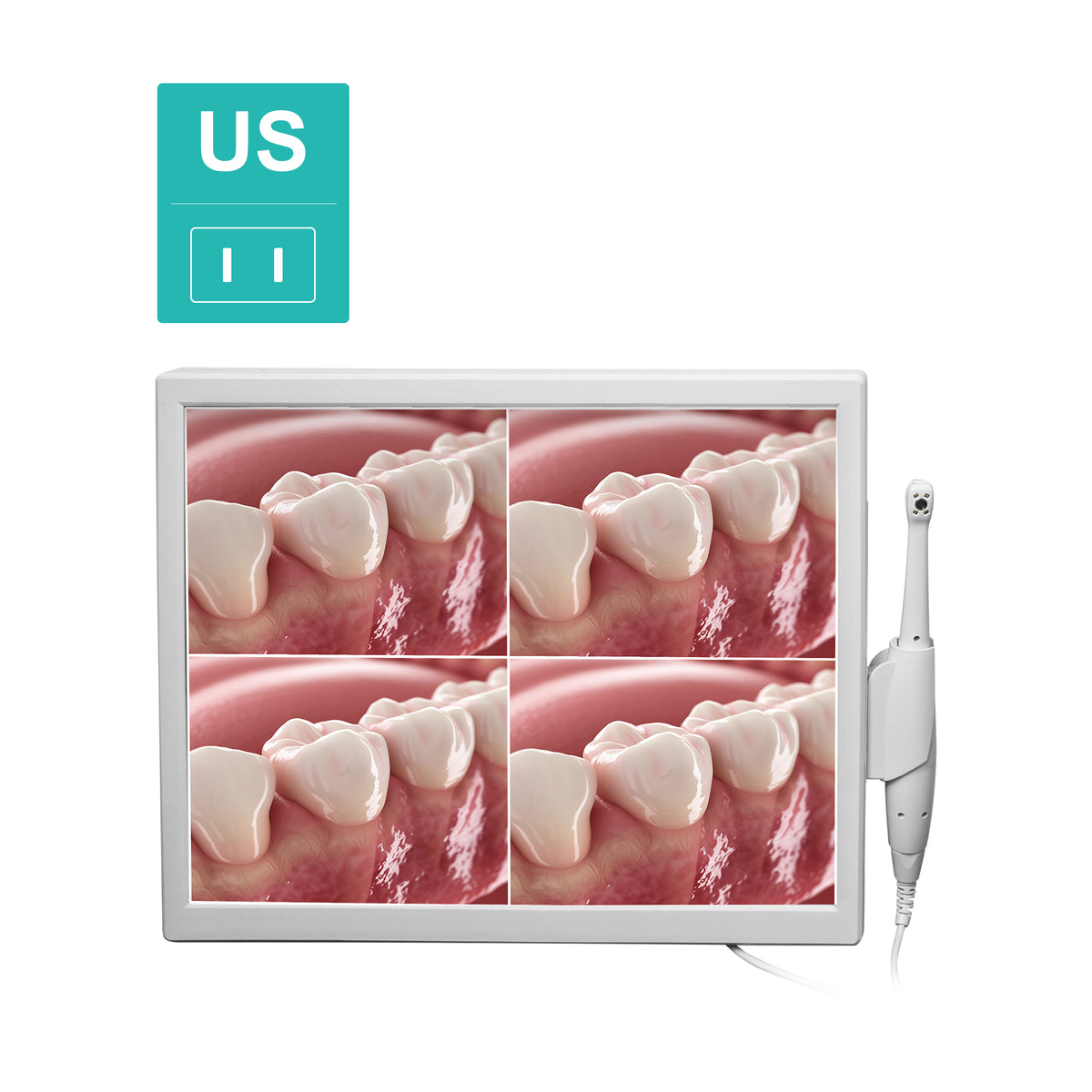 Real intraoral photo captured by 4LED shadowless camera