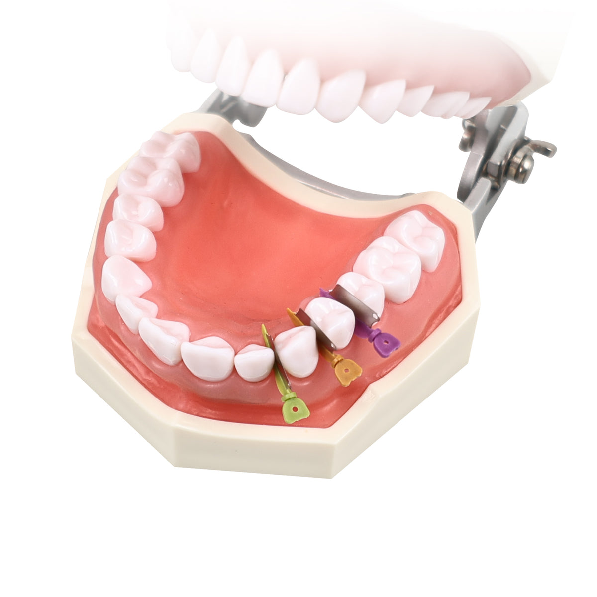 Wedge placed on dental model interproximal space
