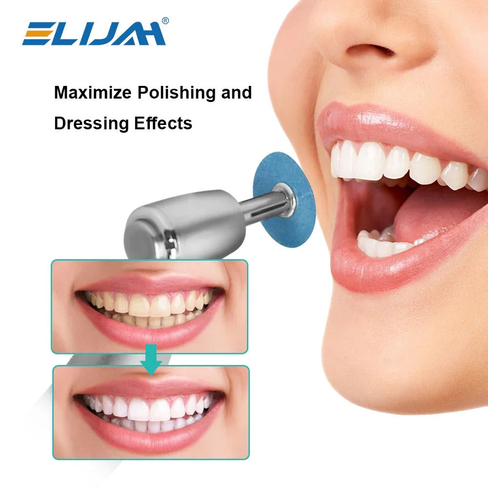 CYF229 Dental Polishing Shank - Denspay Dental - 