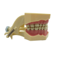 CYW464 Tooth Model