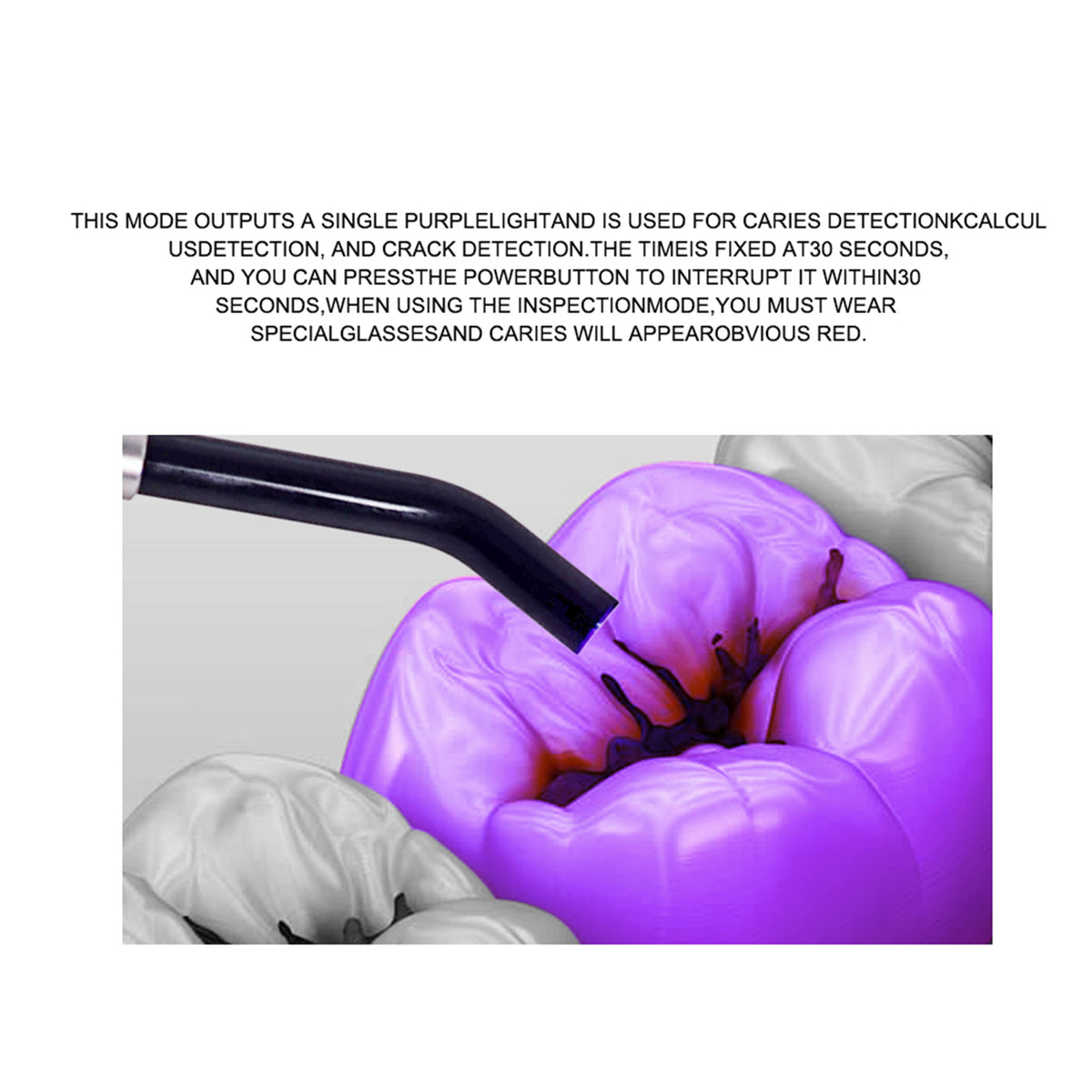 Special observation glasses for dental caries detection mode, supporting accurate lesion viewing
