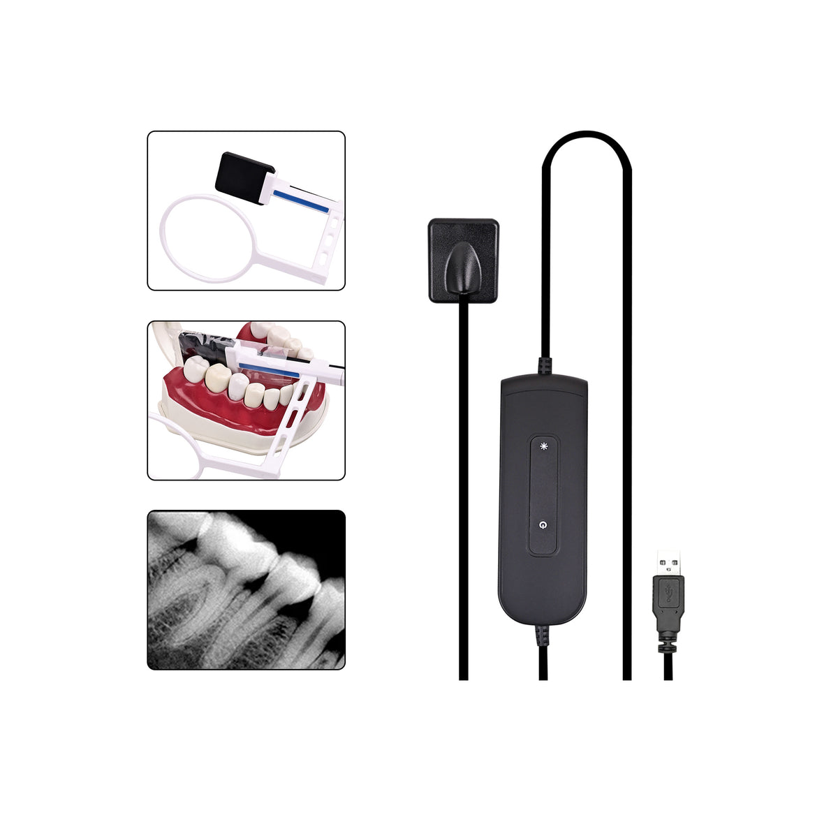 HD dental X-ray image displayed on computer screen