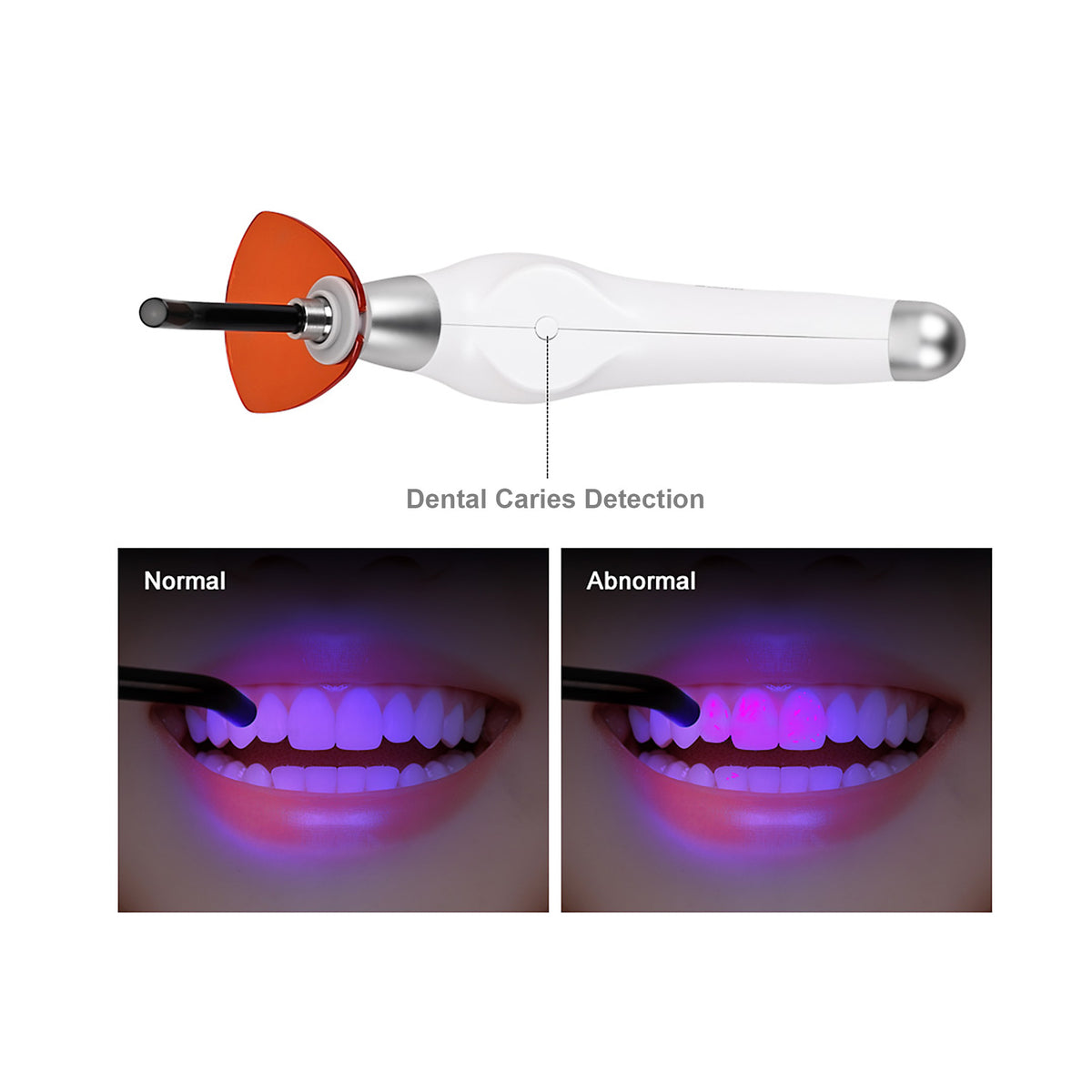 5s fast curing light in dental operatory clinical usage scene