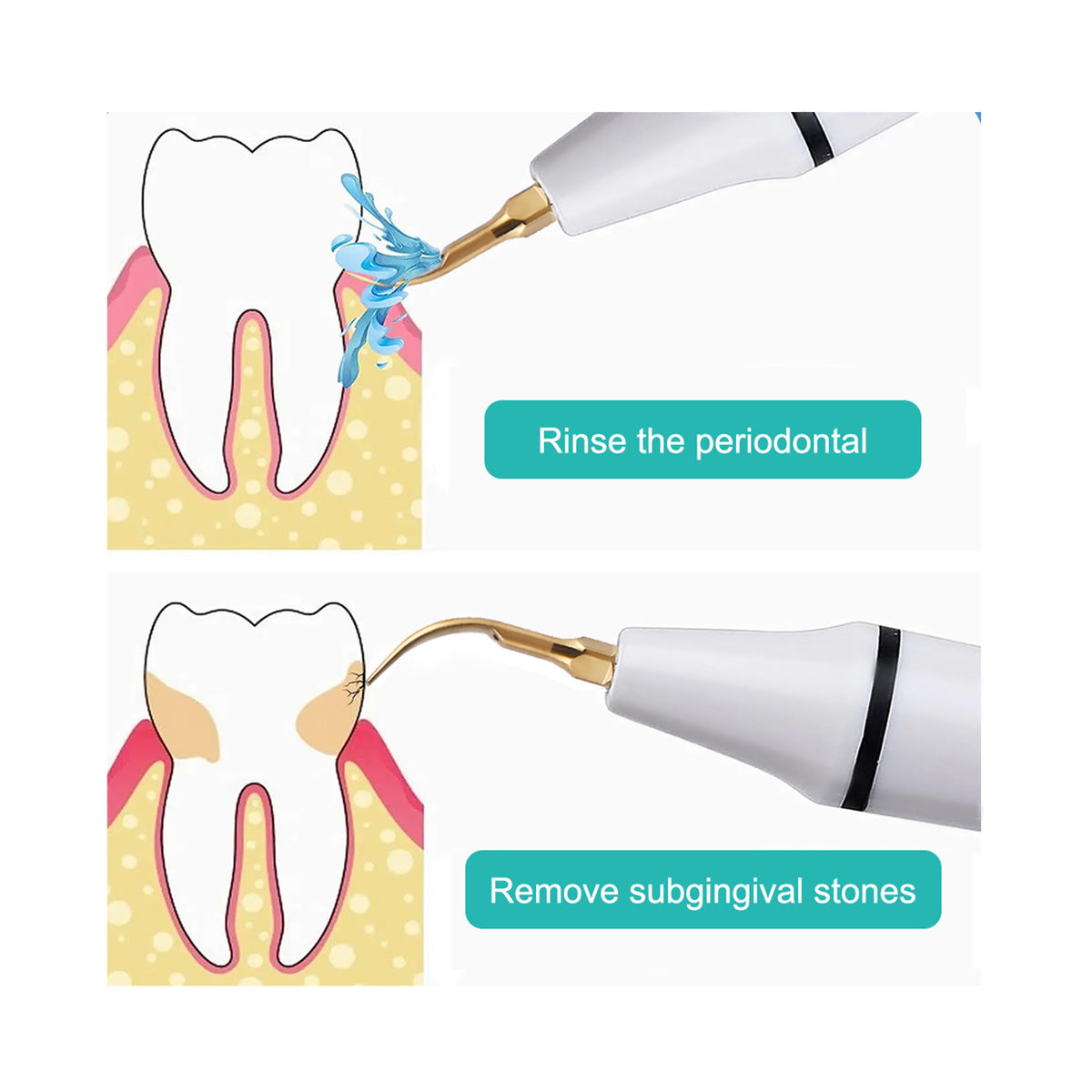 Scaler tips practical using scene in dental clinic