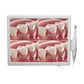 CYN077 Dental Intraoral Camera With Screen - Denspay Dental - Intraoral Camera