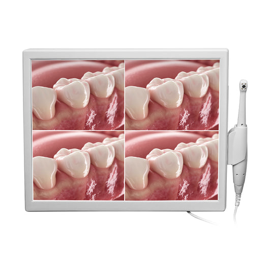CYN077 Dental Intraoral Camera With Screen - Denspay Dental - Intraoral Camera