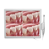 CYN077 Dental Intraoral Camera With Screen - Denspay Dental - Intraoral Camera