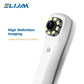CYN075 Dental Intraoral Camera - Denspay Dental - Intraoral Camera