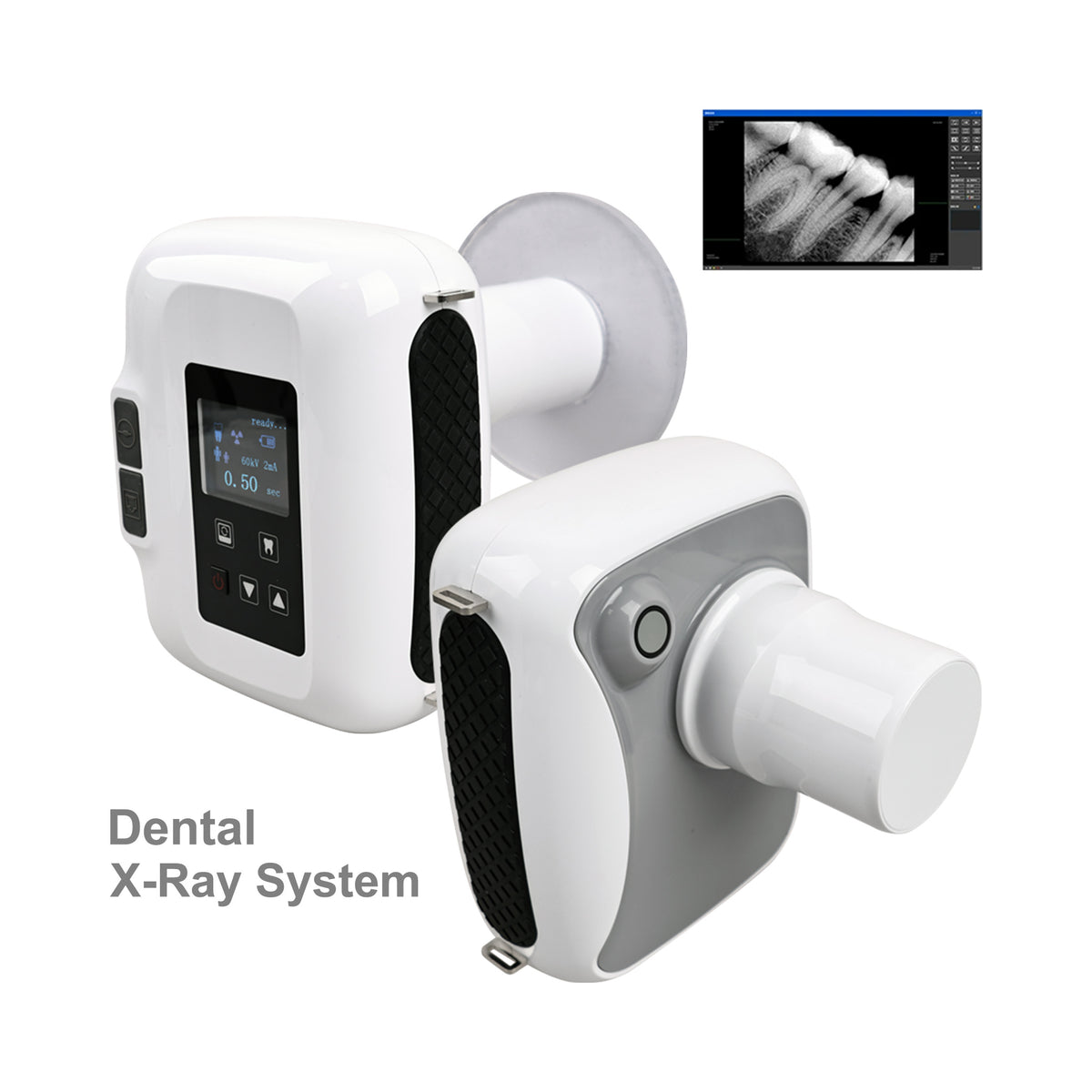 Intraoral X-ray image captured by FOREVERMED YJ-DXP03 dental X-ray unit