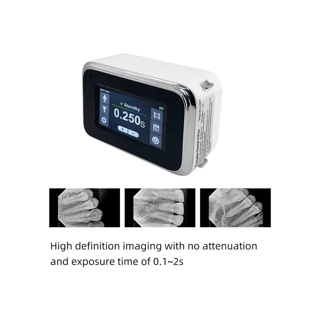 Dental radiographic image result from JINGT RV-350R X-ray machine