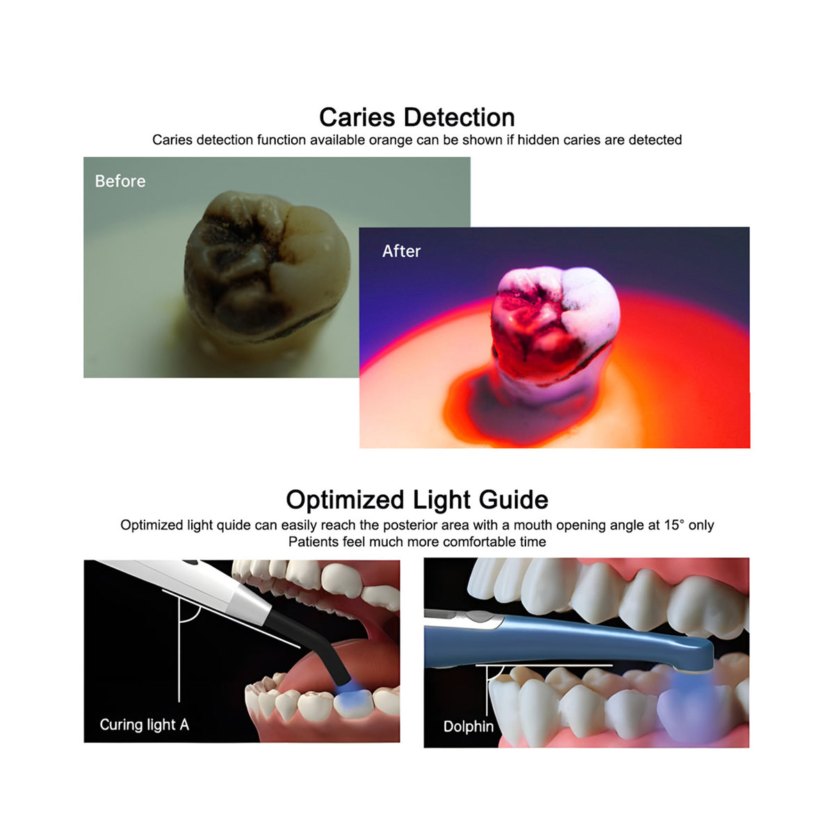 Violet light caries and plaque detection mode of Mecco Dolphin multifunctional curing light
